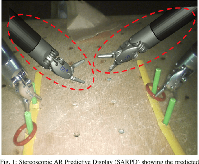 Figure 1 for Augmented Reality Predictive Displays to Help Mitigate the Effects of Delayed Telesurgery