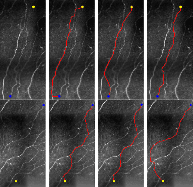 Figure 3 for Minimal Paths for Tubular Structure Segmentation with Coherence Penalty and Adaptive Anisotropy