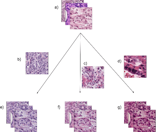 Figure 2 for Inter-Semantic Domain Adversarial in Histopathological Images