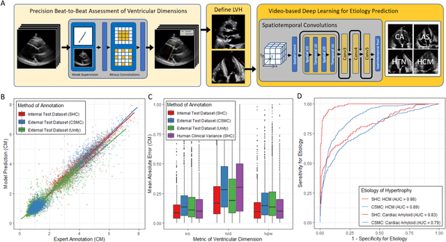Figure 1 for High-Throughput Precision Phenotyping of Left Ventricular Hypertrophy with Cardiovascular Deep Learning
