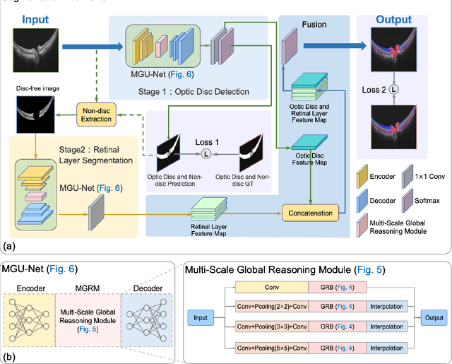 Figure 3 for Multi-scale GCN-assisted two-stage network for joint segmentation of retinal layers and disc in peripapillary OCT images