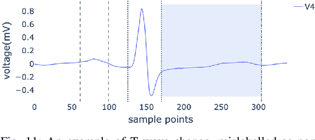 Figure 3 for Identifying Electrocardiogram Abnormalities Using a Handcrafted-Rule-Enhanced Neural Network