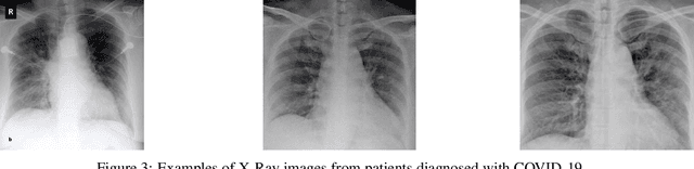 Figure 4 for A free web service for fast COVID-19 classification of chest X-Ray images