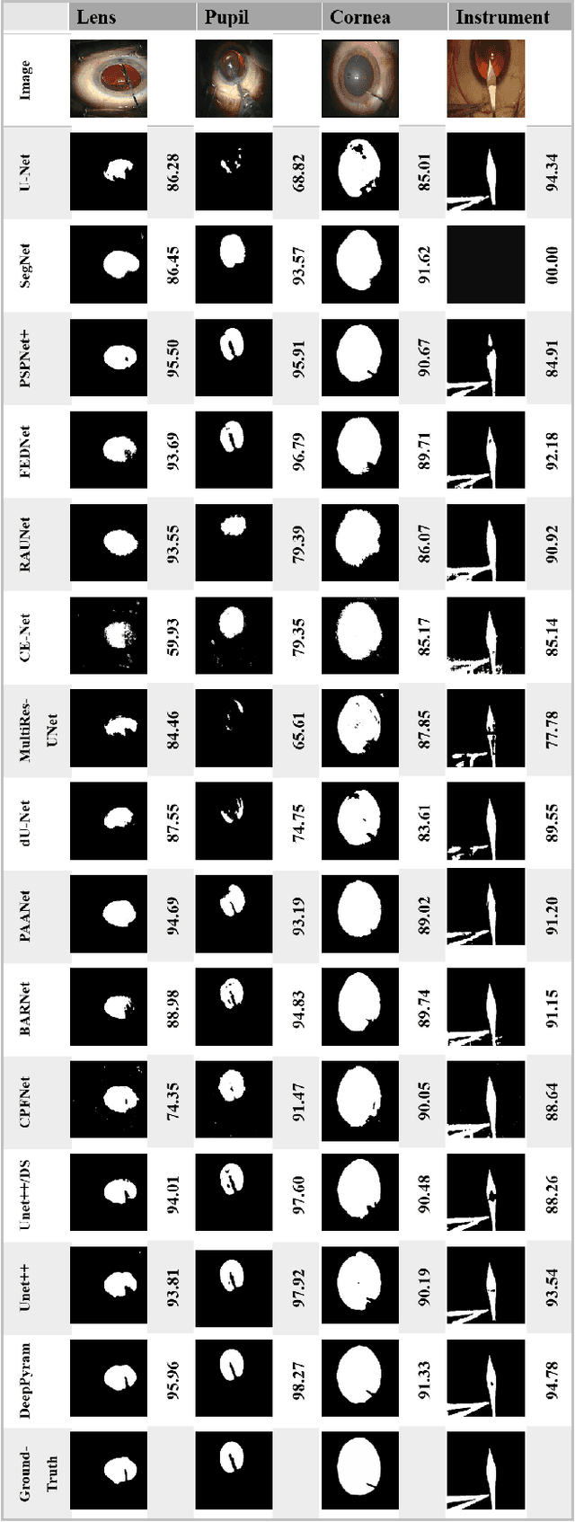 Figure 2 for DeepPyramid: Enabling Pyramid View and Deformable Pyramid Reception for Semantic Segmentation in Cataract Surgery Videos