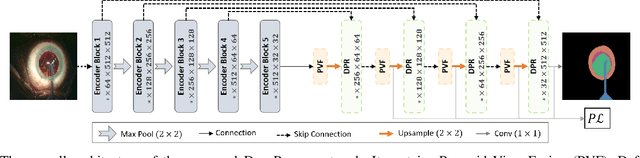 Figure 4 for DeepPyramid: Enabling Pyramid View and Deformable Pyramid Reception for Semantic Segmentation in Cataract Surgery Videos