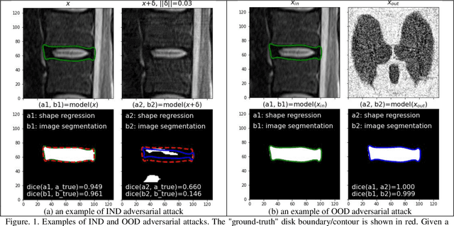 Figure 1 for Adversarial Robustness Study of Convolutional Neural Network for Lumbar Disk Shape Reconstruction from MR images