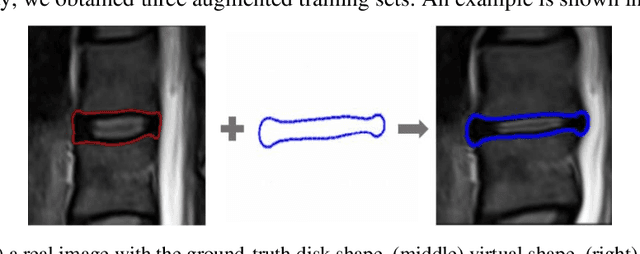 Figure 3 for Adversarial Robustness Study of Convolutional Neural Network for Lumbar Disk Shape Reconstruction from MR images