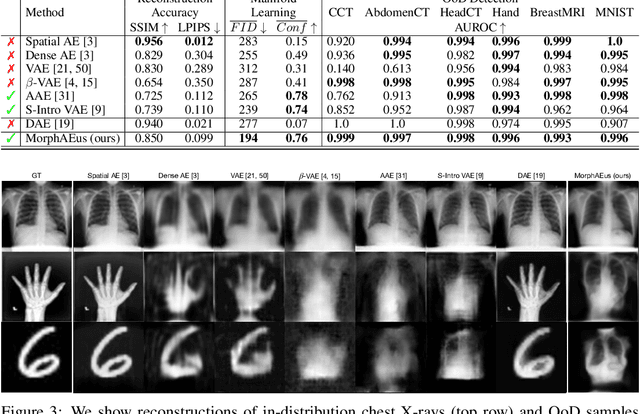 Figure 4 for What do we learn? Debunking the Myth of Unsupervised Outlier Detection