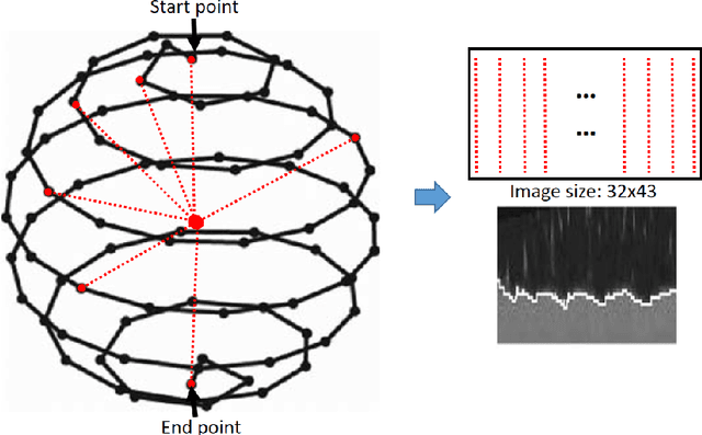 Figure 1 for 2.75D Convolutional Neural Network for Pulmonary Nodule Classification in Chest CT