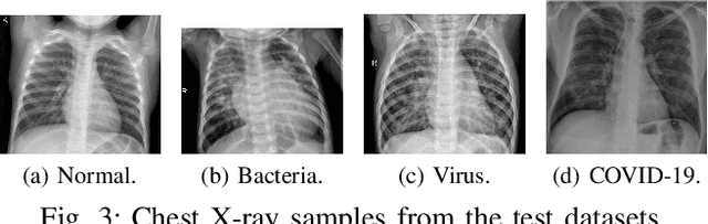 Figure 3 for Deep Learning on Chest X-ray Images to Detect and Evaluate Pneumonia Cases at the Era of COVID-19