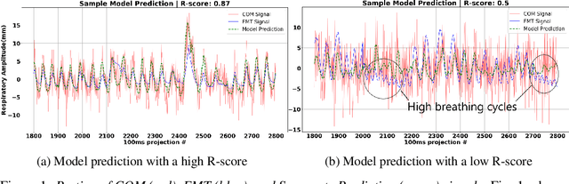 Figure 1 for Learning to estimate a surrogate respiratory signal from cardiac motion by signal-to-signal translation