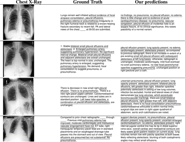 Figure 4 for Medical Image Captioning via Generative Pretrained Transformers