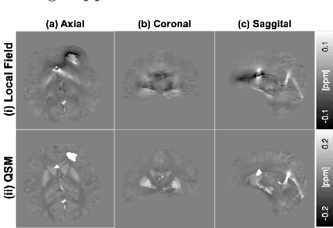 Figure 1 for Non-locally Encoder-Decoder Convolutional Network for Whole Brain QSM Inversion