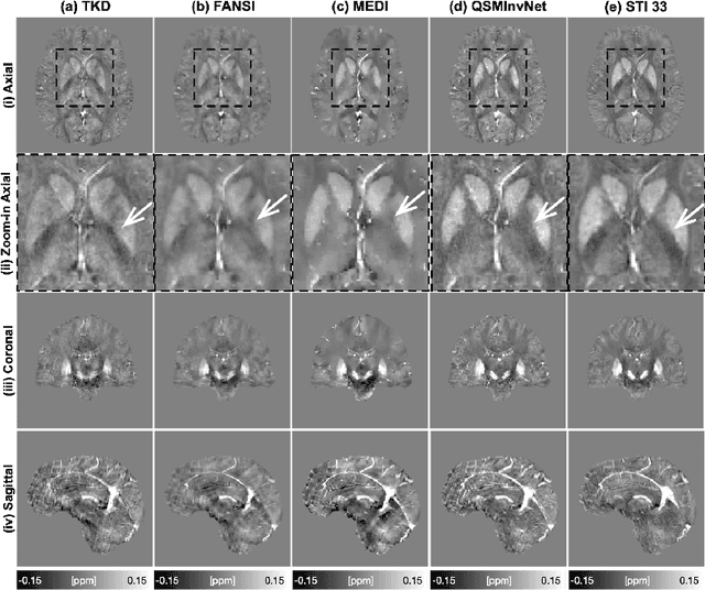 Figure 4 for Non-locally Encoder-Decoder Convolutional Network for Whole Brain QSM Inversion