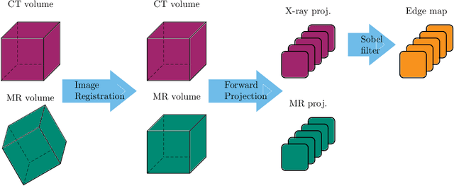 Figure 2 for Projection-to-Projection Translation for Hybrid X-ray and Magnetic Resonance Imaging
