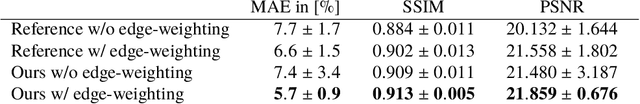 Figure 3 for Projection-to-Projection Translation for Hybrid X-ray and Magnetic Resonance Imaging