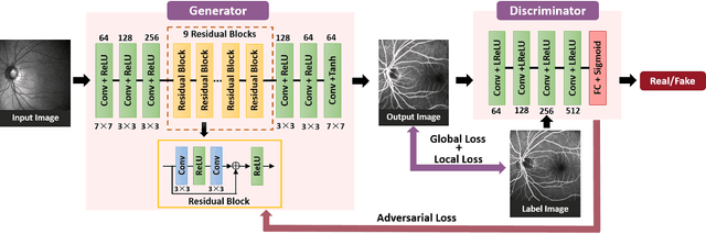 Figure 4 for Generating Fundus Fluorescence Angiography Images from Structure Fundus Images Using Generative Adversarial Networks