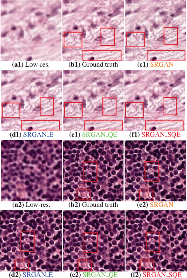 Figure 2 for Robust Super-Resolution GAN, with Manifold-based and Perception Loss