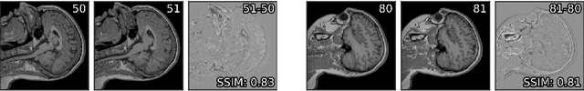 Figure 1 for Noise2Stack: Improving Image Restoration by Learning from Volumetric Data