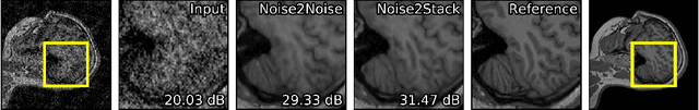 Figure 4 for Noise2Stack: Improving Image Restoration by Learning from Volumetric Data