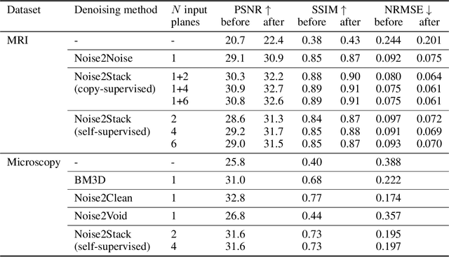 Figure 2 for Noise2Stack: Improving Image Restoration by Learning from Volumetric Data