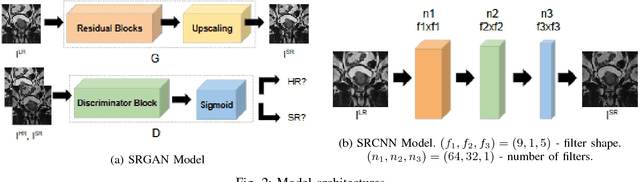 Figure 2 for An Application of Generative Adversarial Networks for Super Resolution Medical Imaging