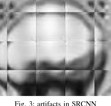 Figure 3 for An Application of Generative Adversarial Networks for Super Resolution Medical Imaging