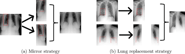 Figure 1 for Challenges in COVID-19 Chest X-Ray Classification: Problematic Data or Ineffective Approaches?