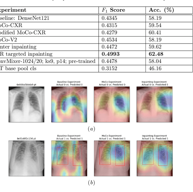 Figure 3 for Challenges in COVID-19 Chest X-Ray Classification: Problematic Data or Ineffective Approaches?