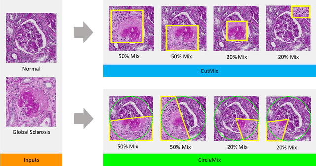 Figure 1 for Improve Global Glomerulosclerosis Classification with Imbalanced Data using CircleMix Augmentation