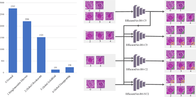 Figure 2 for Improve Global Glomerulosclerosis Classification with Imbalanced Data using CircleMix Augmentation