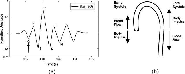 Figure 1 for Ballistocardiogram Signal Processing: A Literature Review