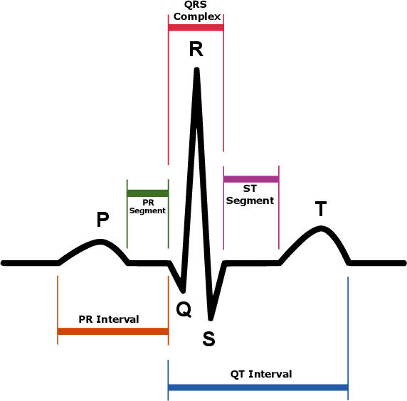 Figure 2 for Ballistocardiogram Signal Processing: A Literature Review