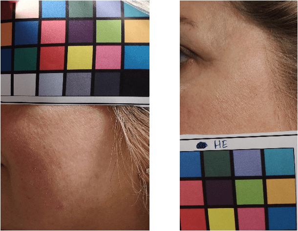 Figure 1 for Tracking Skin Colour and Wrinkle Changes During Cosmetic Product Trials Using Smartphone Images