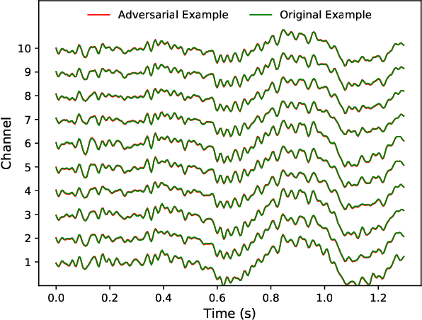 Figure 2 for Active Learning for Black-Box Adversarial Attacks in EEG-Based Brain-Computer Interfaces