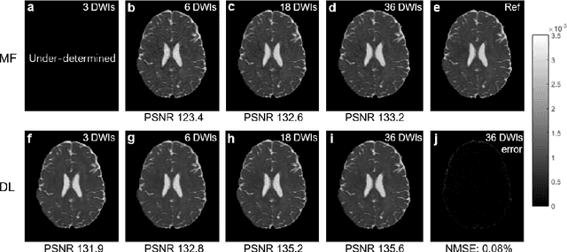 Figure 4 for Deep Learning for Highly Accelerated Diffusion Tensor Imaging