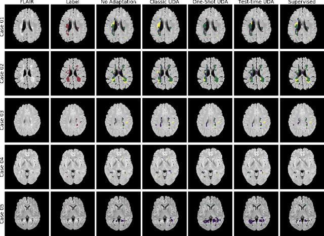 Figure 3 for Test-time Unsupervised Domain Adaptation