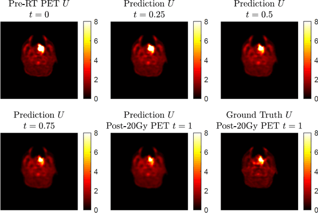 Figure 3 for Post-Radiotherapy PET Image Outcome Prediction by Deep Learning under Biological Model Guidance: A Feasibility Study of Oropharyngeal Cancer Application