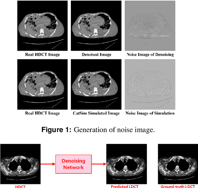 Figure 1 for Noise Entangled GAN For Low-Dose CT Simulation