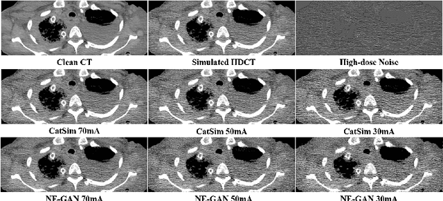 Figure 3 for Noise Entangled GAN For Low-Dose CT Simulation