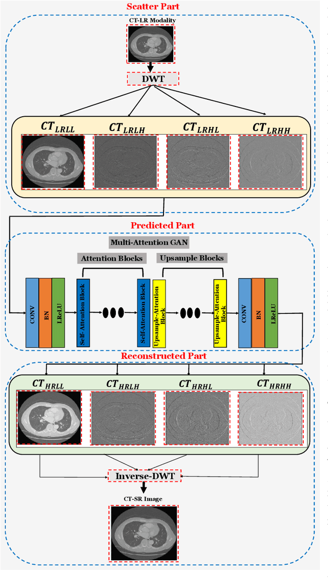 Figure 3 for Multimodal-Boost: Multimodal Medical Image Super-Resolution using Multi-Attention Network with Wavelet Transform