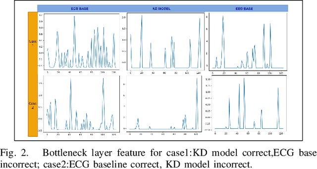 Figure 2 for A Deep Knowledge Distillation framework for EEG assisted enhancement of single-lead ECG based sleep staging