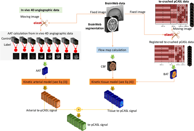 Figure 3 for Fast Dynamic Perfusion and Angiography Reconstruction using an end-to-end 3D Convolutional Neural Network