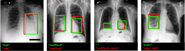 Figure 3 for Improving Pneumonia Localization via Cross-Attention on Medical Images and Reports