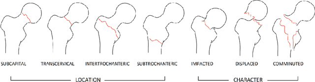 Figure 1 for Producing radiologist-quality reports for interpretable artificial intelligence