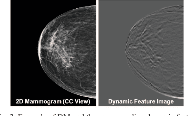 Figure 2 for Joint 2D-3D Breast Cancer Classification