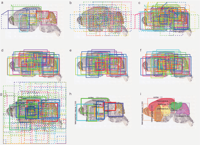 Figure 2 for Developing Brain Atlas through Deep Learning
