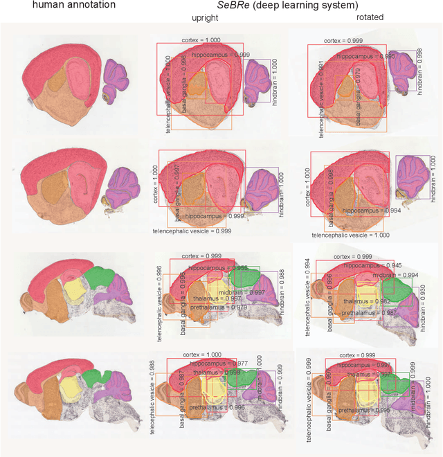 Figure 3 for Developing Brain Atlas through Deep Learning