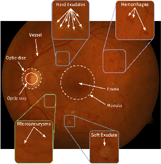 Figure 1 for Ophthalmic Diagnosis and Deep Learning -- A Survey