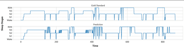 Figure 3 for Pediatric Sleep Scoring In-the-wild from Millions of Multi-channel EEG Signals